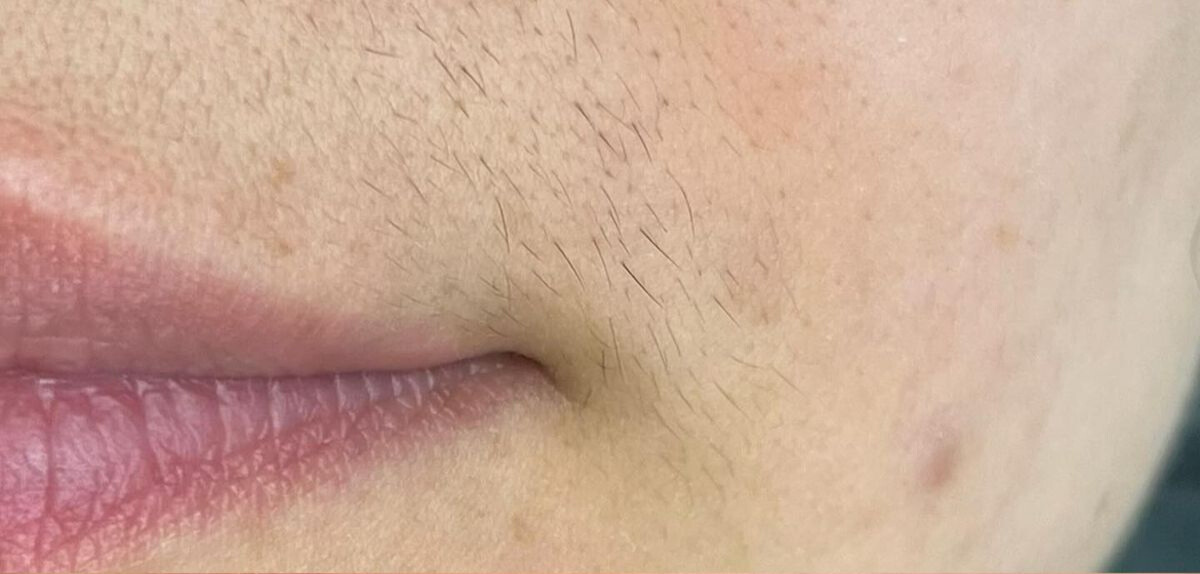 71bbabed-5228-417f-89fd-f8b486bcdafb before